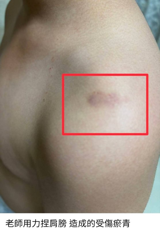 漾新聞|疑遭導師不當管教　高市某國中事件引關注 教育局：零體罰、零容忍