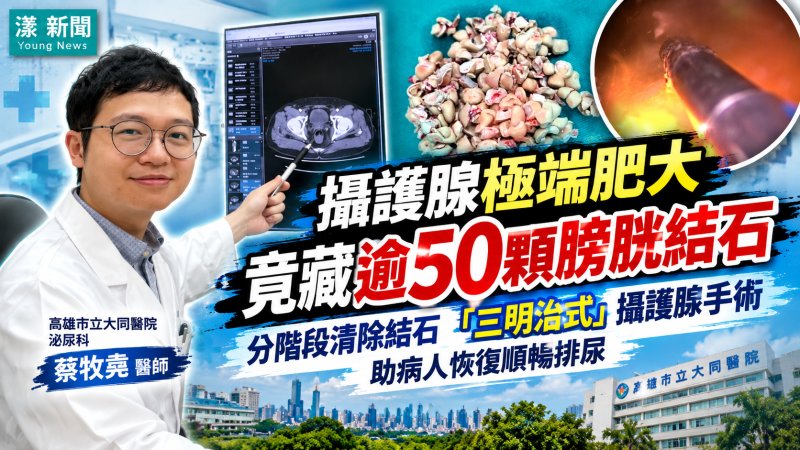 攝護腺肥大藏逾50顆結石　大同醫院三明治手術解危機